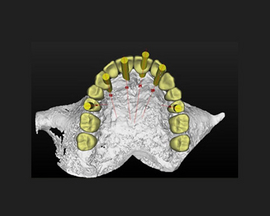 Implantate